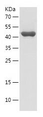    GNPAT / Recombinant Human GNPAT