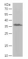    ITGA1 / Recombinant Human ITGA1