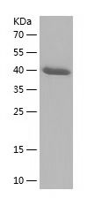    MSRB2 / Recombinant Human MSRB2