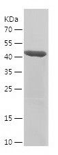    MCM3 / Recombinant Human MCM3