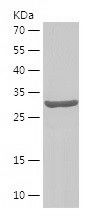    DNAJB12 / Recombinant Human DNAJB12