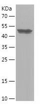    Nucleocapsid / Recombinant Human Nucleocapsid