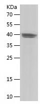    MICAL2 / Recombinant Human MICAL2