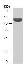    SLC4A4 / Recombinant Human SLC4A4