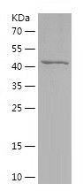    NPC1 / Recombinant Human NPC1