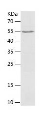    PKLR / Recombinant Human PKLR