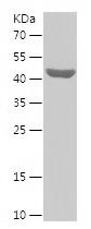    CHKA / Recombinant Human CHKA