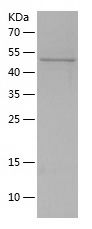    ACP5 / Recombinant Human ACP5