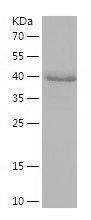 Recombinant Rat.Mouse PINP