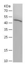    CCT8 / Recombinant Human CCT8