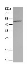    GSTA1 / Recombinant Human GSTA1