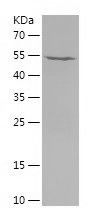    MCM6 / Recombinant Human MCM6