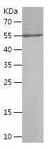    QSOX1 / Recombinant Human QSOX1