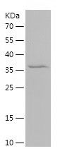    MRPS16 / Recombinant Human MRPS16