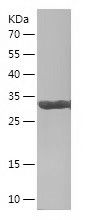    SLC7A11 / Recombinant Human SLC7A11