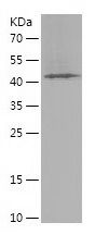    DHX38 / Recombinant Human DHX38