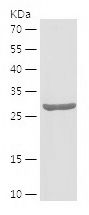    STX6 / Recombinant Human STX6