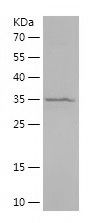    ARPC2 / Recombinant Human ARPC2