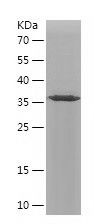    RPS26 / Recombinant Human RPS26