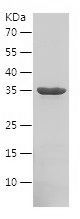    PDE6A / Recombinant Human PDE6A