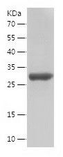    PMM2 / Recombinant Human PMM2