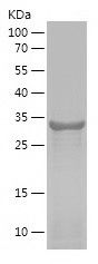    PHF5A / Recombinant Human PHF5A