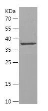    TCOF1 / Recombinant Human TCOF1