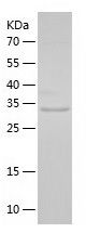    UQCRQ / Recombinant Human UQCRQ