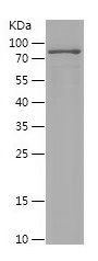 Recombinant Mouse  ROCK1