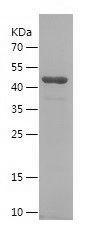    XRCC1 / Recombinant Human XRCC1