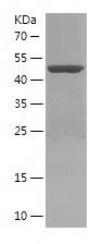    IGSF11 / Recombinant Human IGSF11