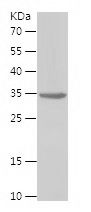    CXCL17 / Recombinant Human CXCL17