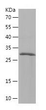    PMEPA1 / Recombinant Human PMEPA1