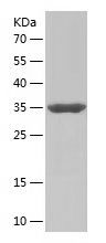    TIMM9 / Recombinant Human TIMM9