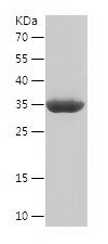    TPM4 / Recombinant Human TPM4