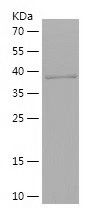    CSF1 / Recombinant Human CSF1