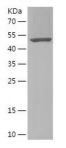    ABCG5 / Recombinant Human ABCG5