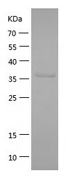    SARS1 / Recombinant Human SARS1