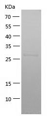    SARS2 / Recombinant Human SARS2