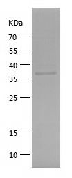 Recombinant spike glycoprotein RBD [2019-Novel Coronavirus]