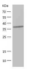    QPCT / Recombinant Human QPCT