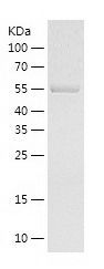    QPCTL / Recombinant Human QPCTL