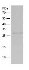    MCPIP-1 / Recombinant Human MCPIP-1