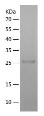    TSHR / Recombinant Human TSHR