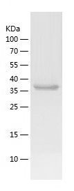 Recombinant Endonuclease V