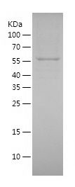 Recombinant Rat PDGFRB