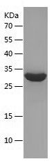    PTH(39-84) / Recombinant Human PTH(39-84)