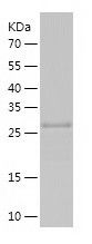    CCR2 / Recombinant Human CCR2