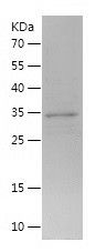Recombinant Mouse SAA4