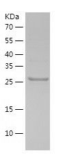    ZNF320 / Recombinant Human ZNF320